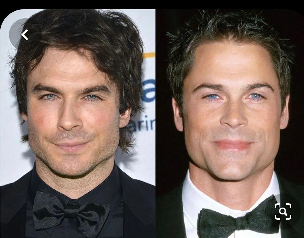 Знаменитости с вытянутым лицом. Нос с горбинкой. Красивый нос. Ринопластика кончика носа. Скошенный подбородок.