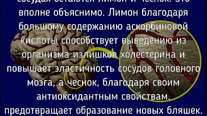 Сосуды головного мозга лечение народными средствами. Очищение сосудов головного мозга. Продукты для очищения сосудов головного мозга. Чистка сосудов головного МО. Как чистить сосуды головного мозга.