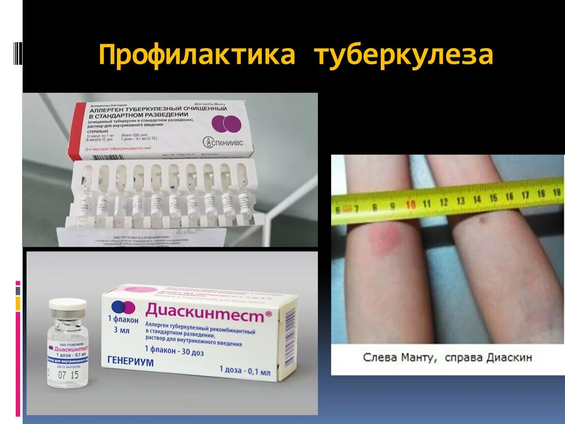 Он изготовил лекарство от туберкулеза. Препараты от туберкулеза. таблетки для профилактики туберкулеза. профилактика туберкулеза препараты. препататы для профилактики туберкулёза.