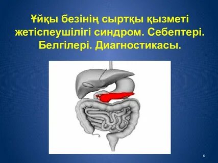 Ерлерге арналған жыныстық қатынасқа арналған әбзелдер