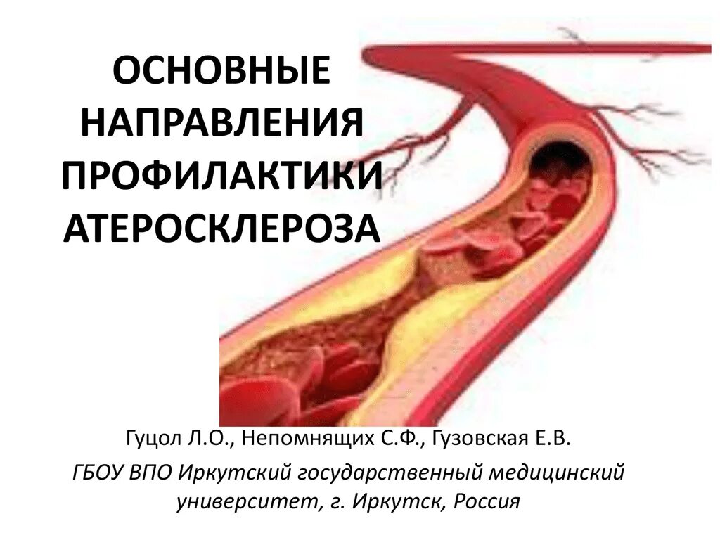 Отдел атеросклероза. Профилактика атеросклероза. атеросклероз буклет. атеросклероз памятка. профилактика атеросклероза памятка.