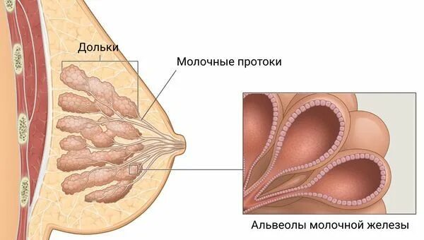 Фиброма в груди. Фиброма молочных желез. Молочные протоки. Фиброма в грудной железе. Фиброма левой молочной железы.