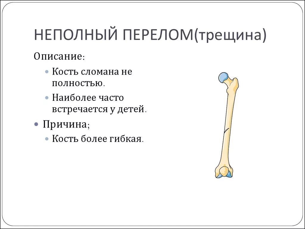 Полный и не полный передом. Неполные переломы костей. Неполный перелом кости. Симптомы перелома или трещины