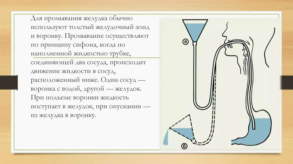 Технология промывания желудка через зонд. Техника промывания желудка через зонд алгоритм. Промывание желудка зондовым методом алгоритм. Промывание желудка толстым зондом алгоритм. Вода из желудка уходит