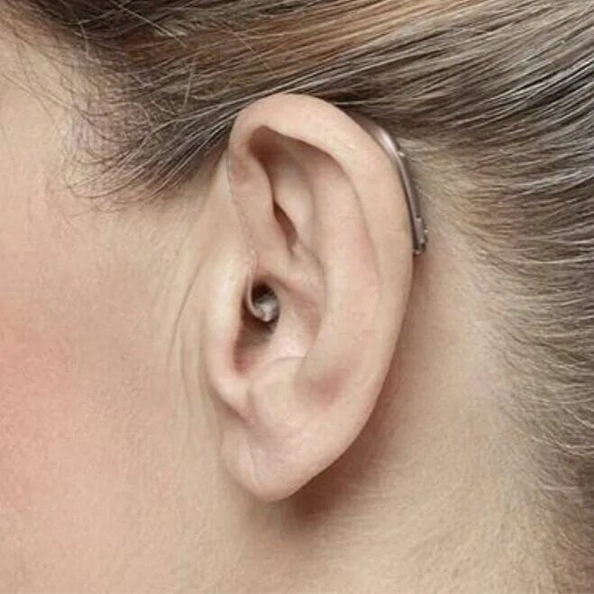 Слуховой аппарат Oticon. Hearing Aid слуховой аппарат. Oticon слуховой аппарат архив. 0 hearing