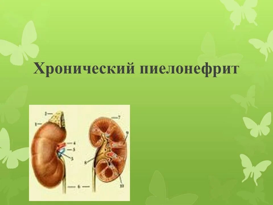 Хронический пиелонефрит что это. Хронический пиелонефрит. Хроническийпиеленефрит. Хроничечки йпиелонефрит. Хронический пиелонефрит презентация.