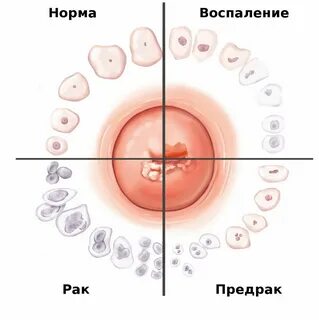Шейка матки можно ли нащупать