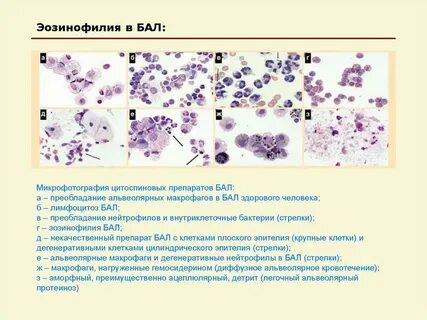 Альвеолярные эпителиальные клетки второго типа