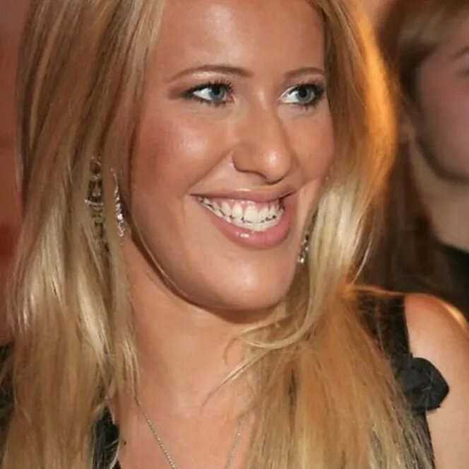 ксения собчак прикус. собчак прикус. ксения собчак до и после пластики. ксения собчак. собчак прикус.