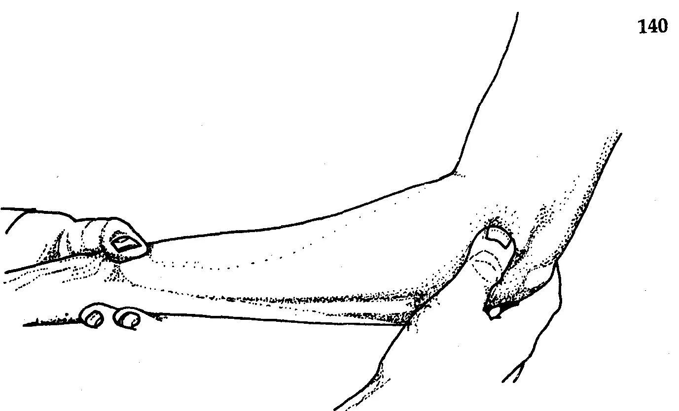 Гониометрия локтевого сустава. Норма объема движений в суставах конечностей. Разгибательная контрактура локтевого сустава. Ограничение движения локтевого сустава. Объем движений в локтевом суставе.