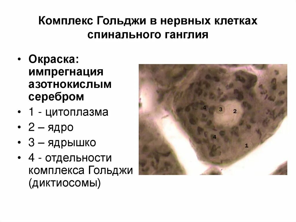 Клетки спинномозгового узла. Комплекс Гольджи окраска импрегнация осмием. Аппарат Гольджи строение гистология. Аппарат Гольджи в нервных клетках спинального ганглия гистология. Комплекс Гольджи в нервных клетках спинального ганглия кошки.