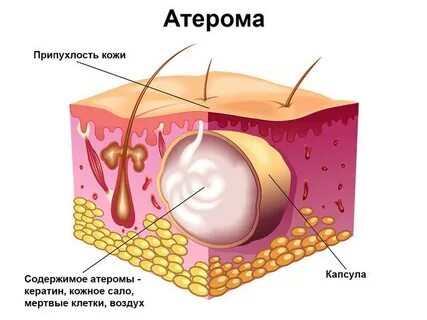 Жировые выделения кожи