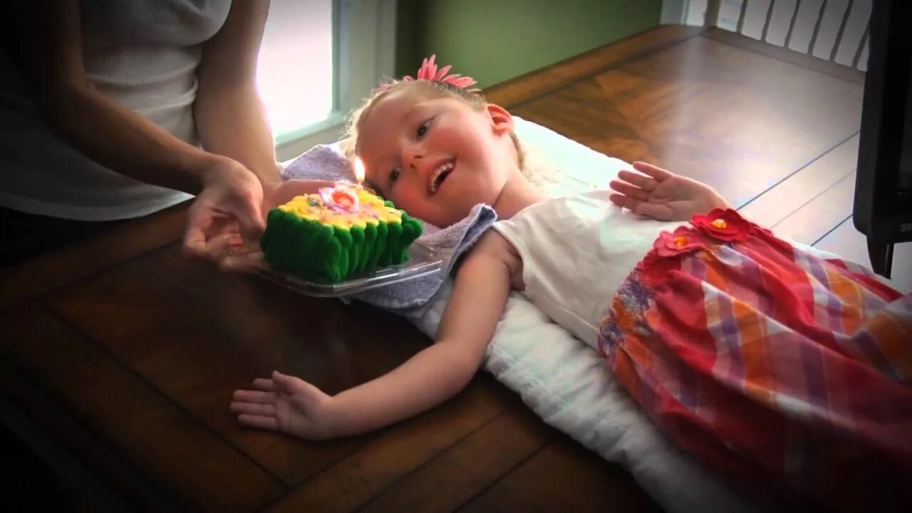 Спинальная амиотрофия верднига гоффмана 2 тип. Спинанпльномышечная атрофия. Спирально мышечная атрофия. Спинальная мышечная амиотрофия. Болезнь верднига гоффмана.