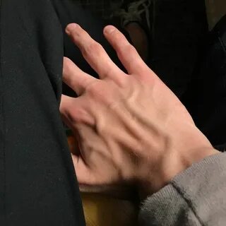 Битые руки парня