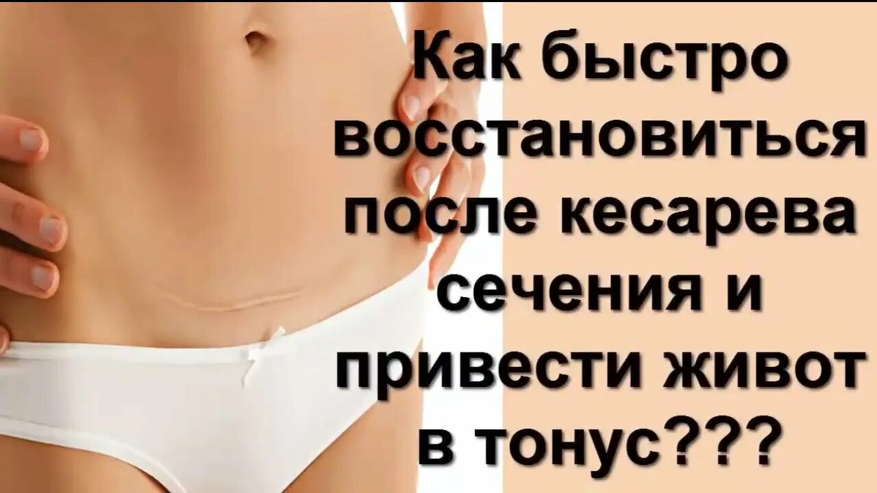 Как убрать живот после кесарева сечения. Упражнения после кс для живота. упражнения для живота после кесарева сечения. упражнения после кесарева сечения чтобы убрать живот. упражнения для живота после родов кесарево сечение.