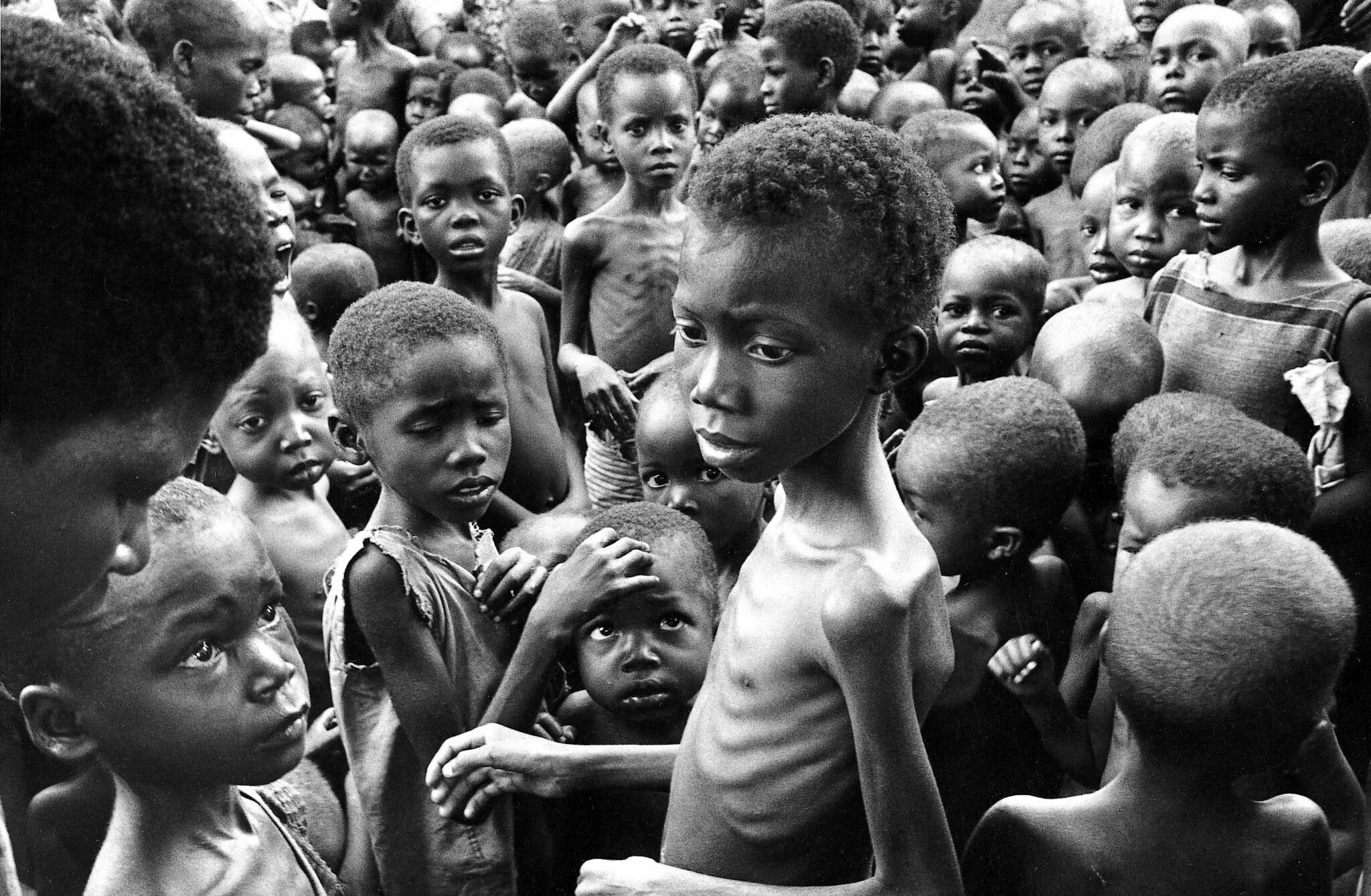 Starving people