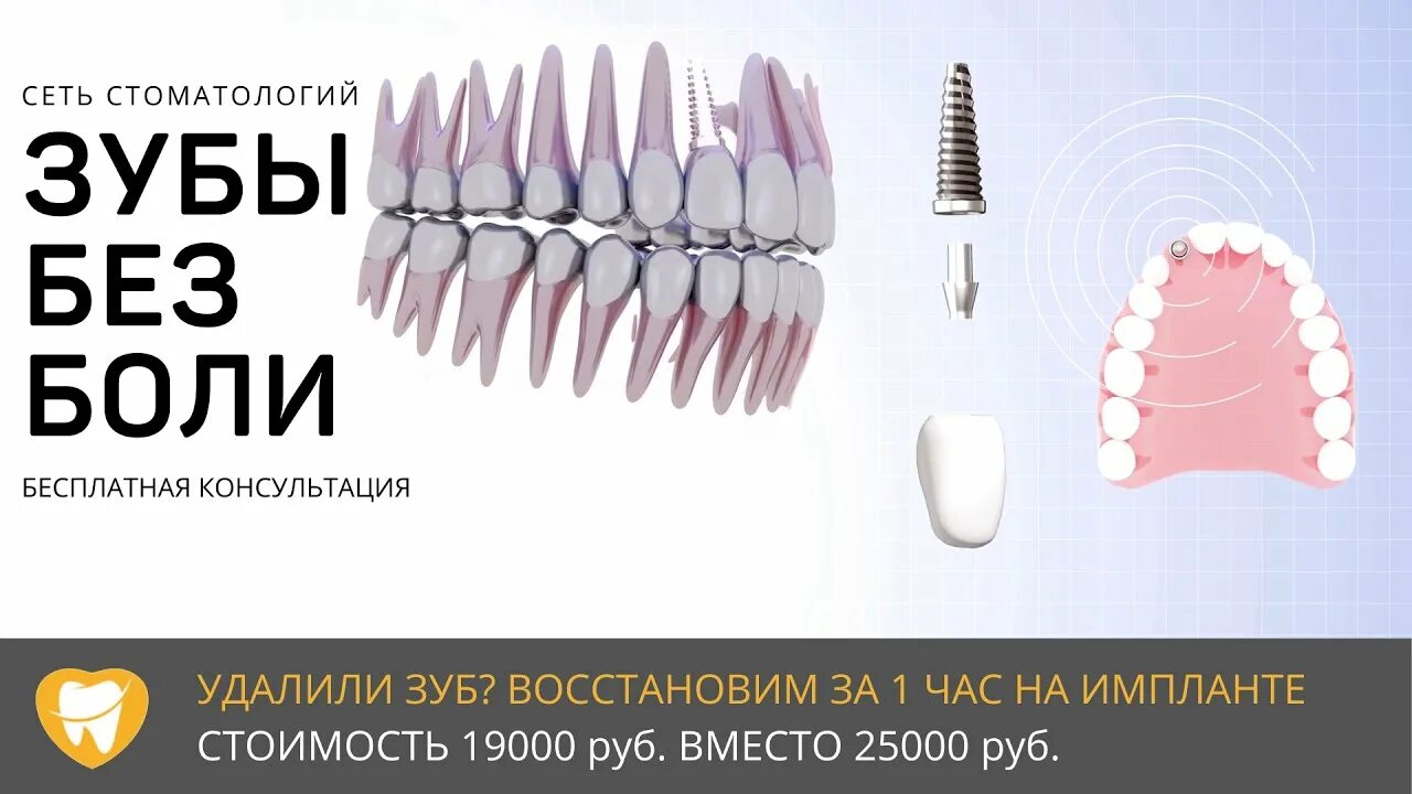 Вставить зубы недорого тюмень. Имплантация зуба ульяновск. имплантация зубов без боли. имплантация зубов в ульяновске. зубы импланты ульяновск.
