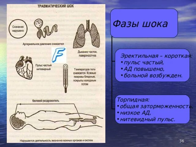 Эректильный шок. Фазы шока. Торпидная фаза травматического шока. Эректильная фаза шока. Признаки торпидной фазы шока.