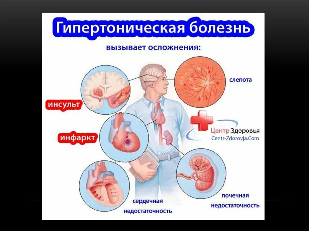 Органы мишени при артериальной. Гипертоническая болезнь органы мишени. Органы мишени артериальной гипертонии. Органы мишени при гипертонической гипертонией. Гипертоническая болезнь поражение органов мишеней.