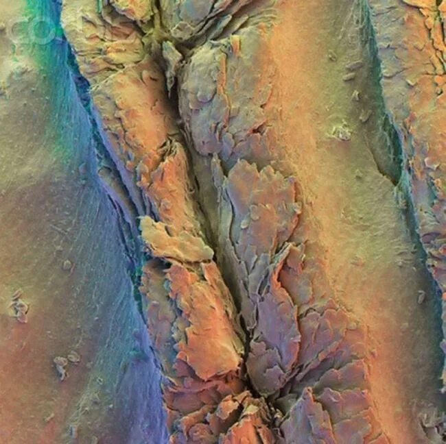 Ноготь под микроскопом человека. Человеческий ноготь под микроскопом. Микоз ногтей под микроскопом. Как выглядит ноготь под микроскопом. Как выглядит ноготь под микроскопом.