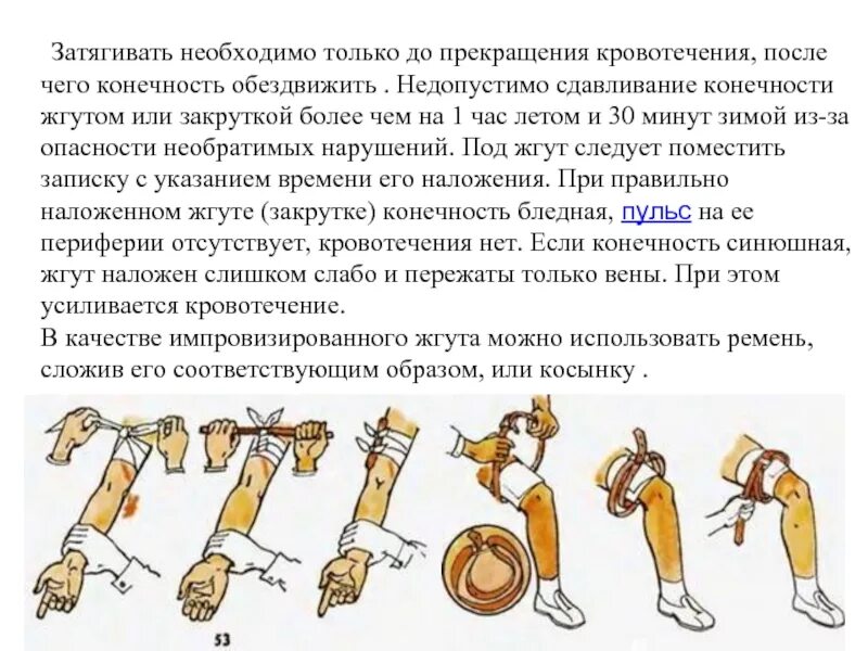 В качестве импровизированного жгута можно использовать. Наложение жгута при сдавлении конечностей. наложение защитных жгутов при сдавливании конечностей. оказание первой помощи при сдавливании конечностей. оказание первой помощи при сдс.