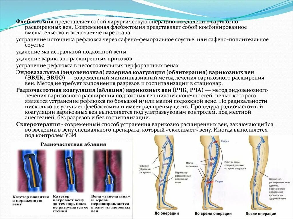 Рекомендации после операции вен. Варикозное расширение подкожных вен нижних конечностей. Флебэктомия БПВ протокол операции. Комбинированная флебэктомия ход операции.