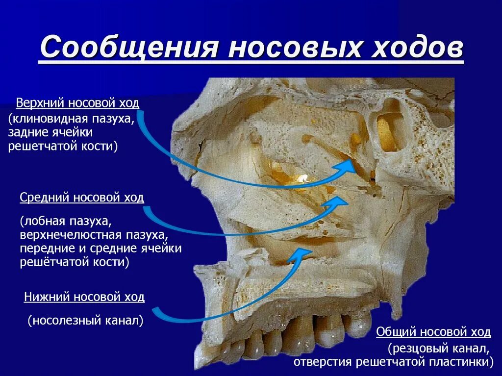 В верхний носовой ход открывается пазуха. Сообщения носовой полости анатомия. Носовые ходы. Верхний носовой ход.