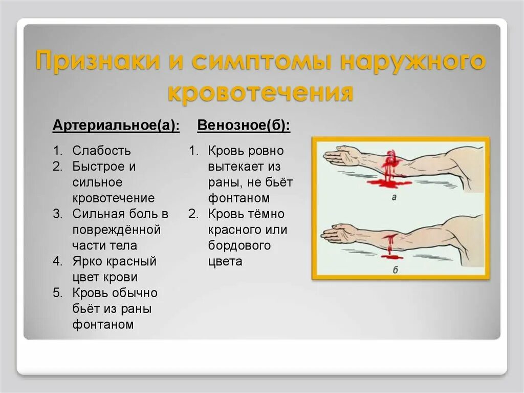 Кровотечения 8 класс биология. Симптомы артериального кровотечения биология 8 класс. Характерные признаки наружного кровотечения. 3.Каковы основные признаки наружного кровотечения?. Перечислите признаки артериального кровотечения.