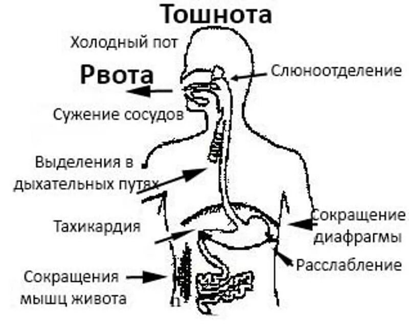 Рвотный рефлекс рвота. КПК избавится от тышноты. Рвота схема. Как избавитьтсяоо тошноты. Как избавиться от тошноты в домашних.