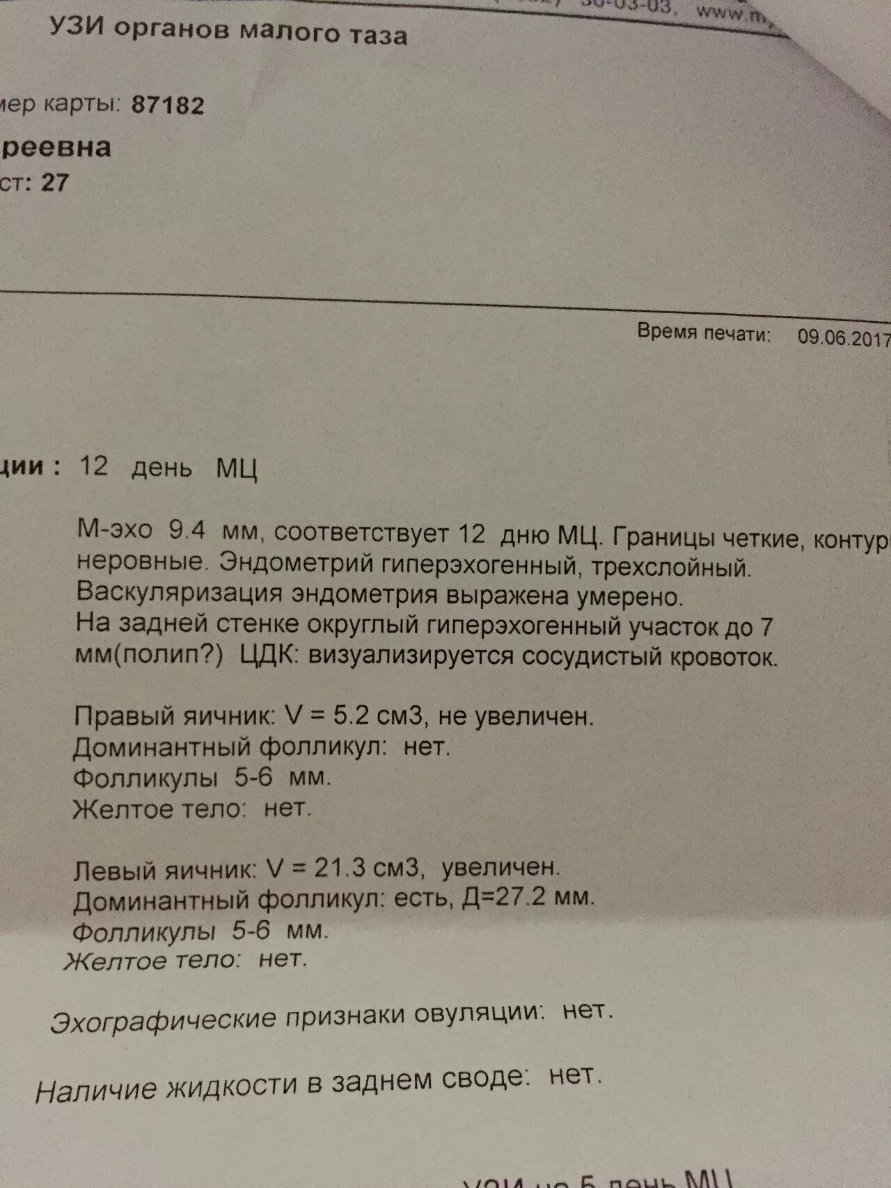 Задний свод матки. Свободная жидкость в заднем своде. по узи в заднем своде жидкость. жидкость в заднем своде при узи. свободная жидкость в заднем своде нормы.