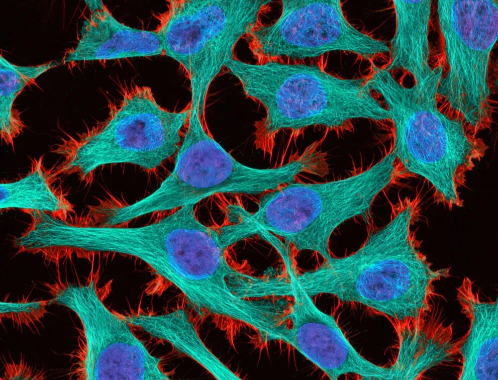 Микроскопические изменения в клетках. Hela клетки. Культура клеток hela. Линия клеток hela.