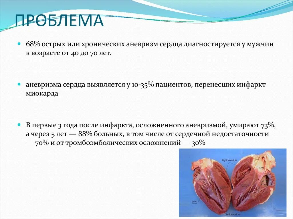 Аневризма сердца что это такое симптомы. Острая и хроническая аневризма. Острая и хроническая аневризма левого желудочка. Хроническая аневризма сердца.