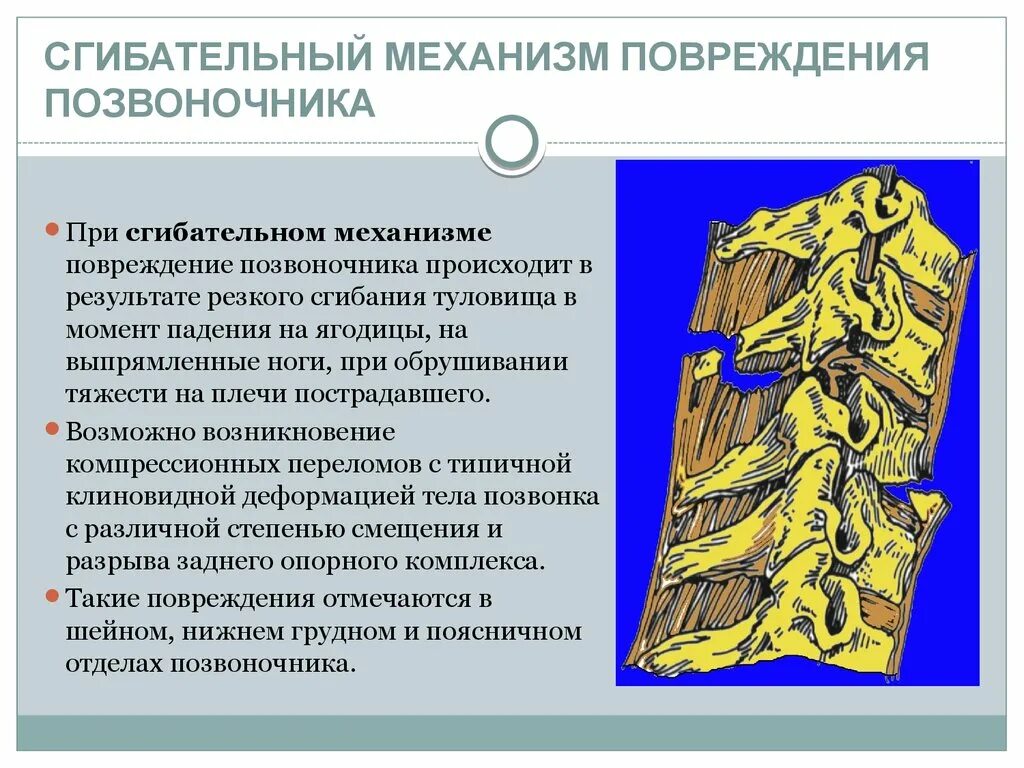 Повреждение позвоночника механизм повреждения. Сгибательно вращательный механизм повреждения позвоночника. Поврежденияпозвоночник. Механизм перелома позвоночника.