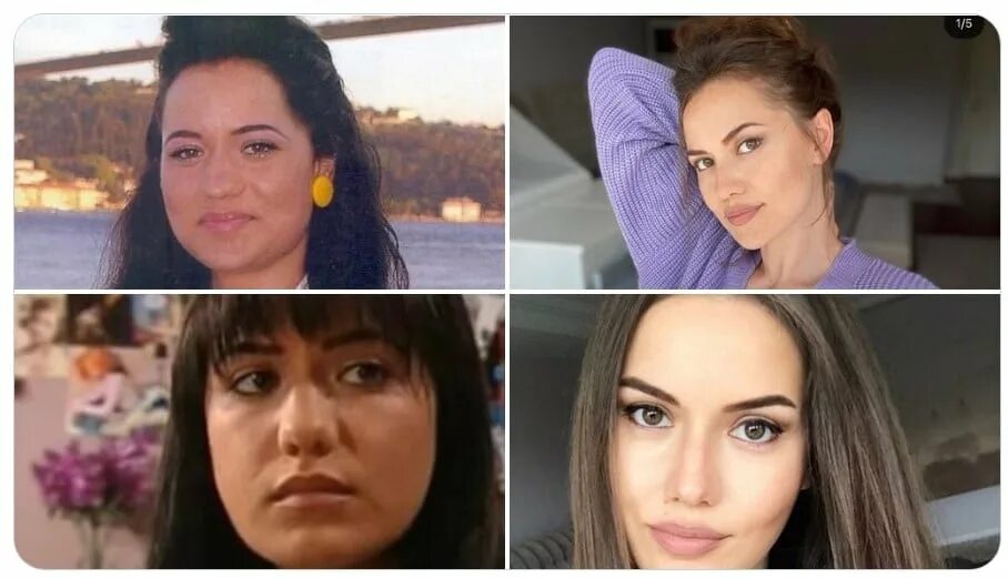 фахрие эвджен до пластики