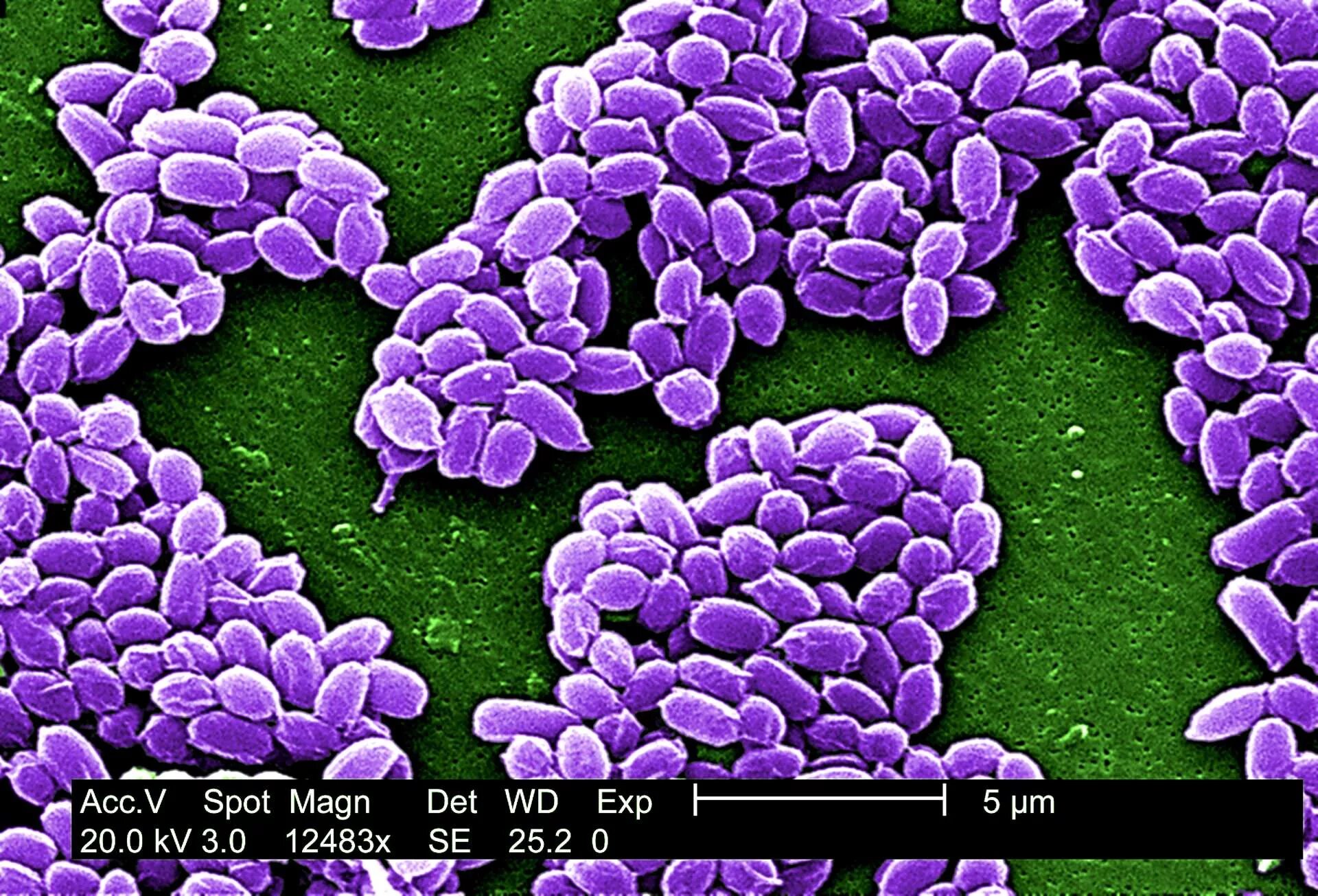 Bacillus anthracis Сибирская язва. Bacillus anthracis патогенность.