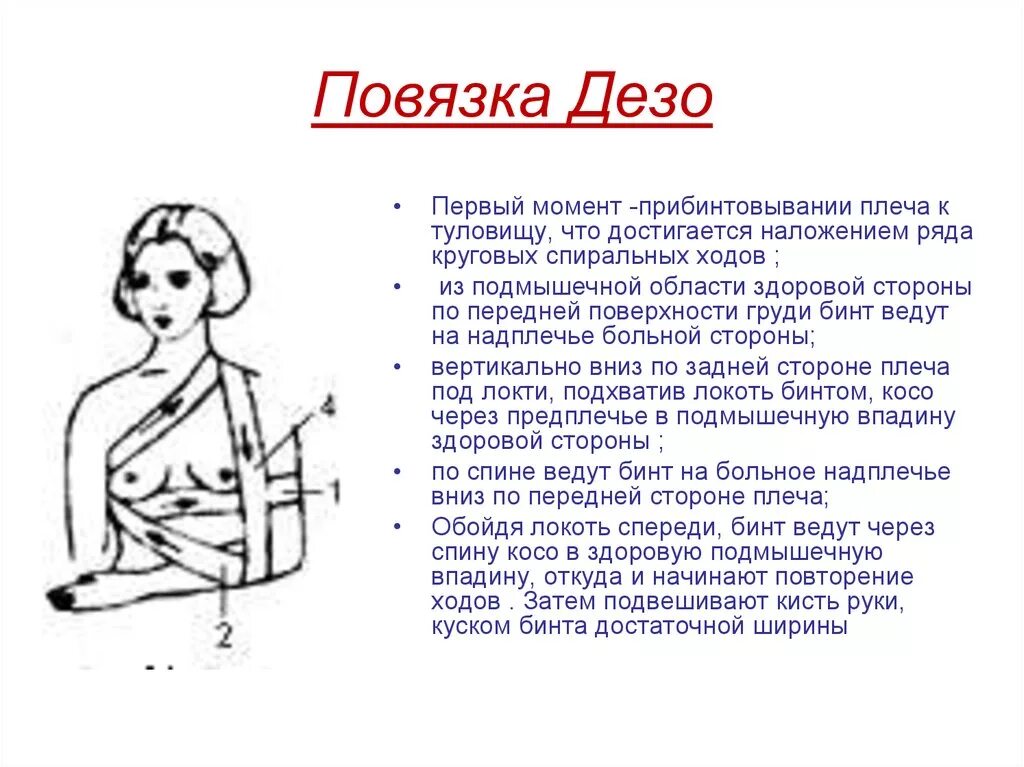 Плечевая повязка алгоритм. Порядок наложения повязки Дезо. Методика наложения повязки Дезо. Повязка Дезо техника наложения. Технику наложения повязки Дезо..