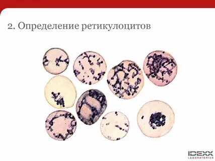 Фракция незрелых ретикулоцитов повышена у мужчин