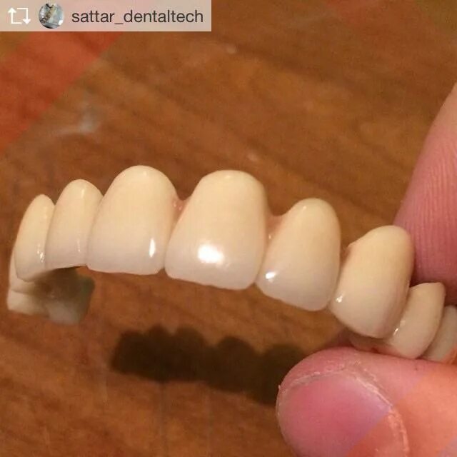 зубные техники керамисты. зубной техник махачкала. багаев стоматология. зубной техник махачкала. зубной техник махачкала.