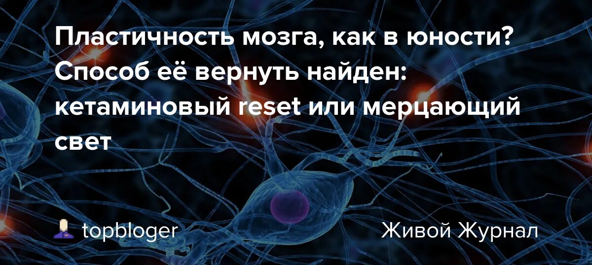 Нейропластичность мозга. Нейронная пластичность мозга. НЕЙРОПЛАСТИКА мозга упражнения. Виды нейропластичности. Мозг пластичен