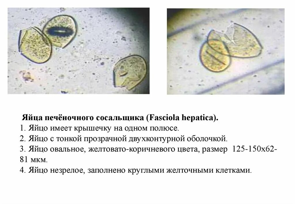 Fasciola яйца. Яйца Fasciola hepatica размер. Яйца печеночного сосальщика. Яйцо печеночного сосальщика препарат.