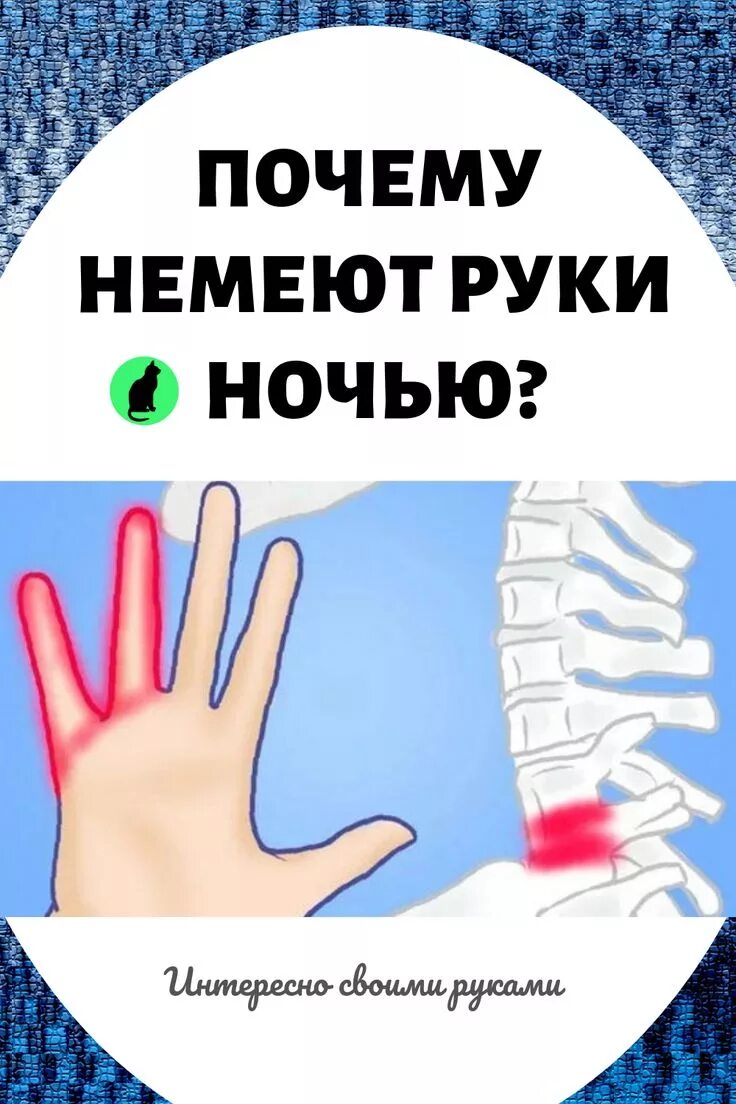 Почему немеют ноги ночью. Почему немеют руки.