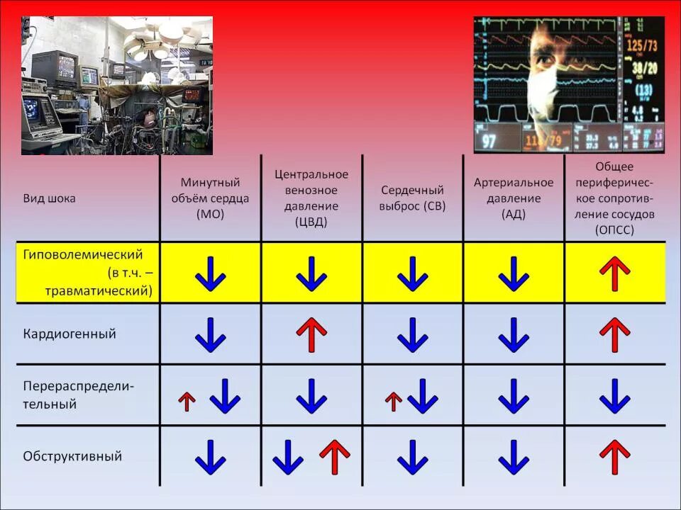 Гемодинамика шока. Виды нарушения гемодинамики. Гемодинамические нарушения при кардиогенном шоке. Нарушение гемодинамики при шоке. Гемодинамические изменения при шоке.