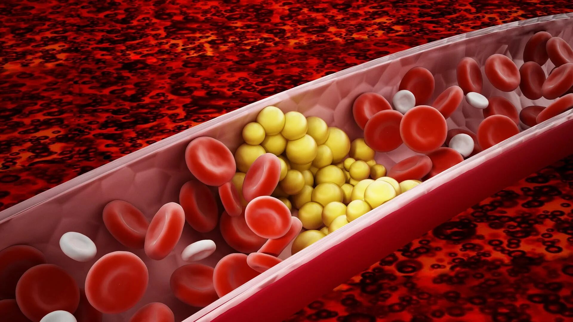 Холестерин в крови. Холестерин Triglyceride. Триглицериды в крови.