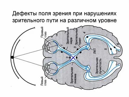 Физиологический дефект