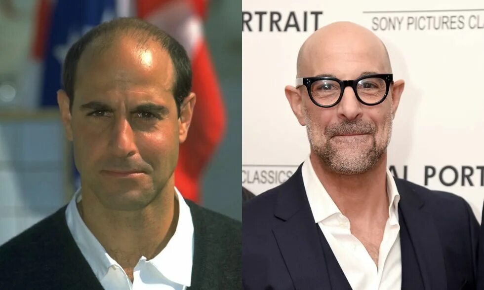 What Bald Actors Look Like Before and After Shaving