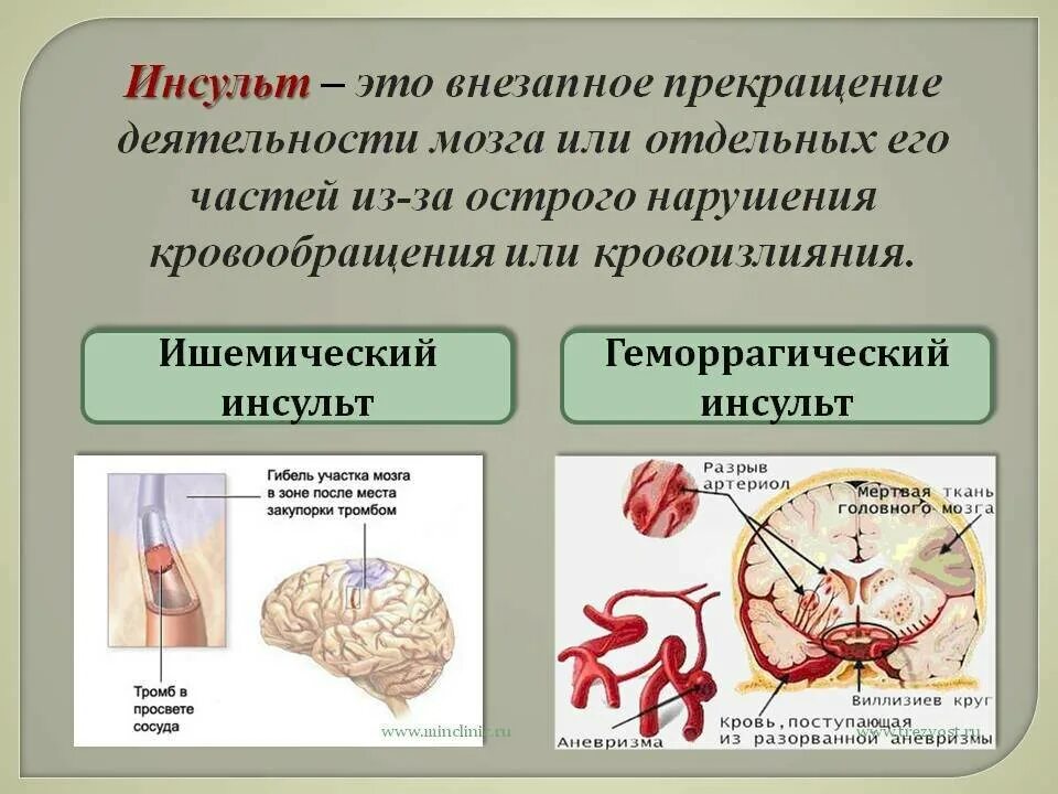 От чего происходит инсульт простыми словами