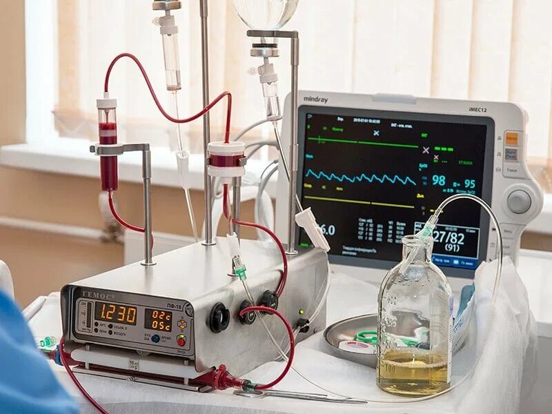Плазмоферез что это. Плазмаферез аппарат Гемос. Аппарат для плазмафереза "Гемос-ПФ". Аппарат Гемма плазмаферез. Аппарат для гемосорбции Гемос.