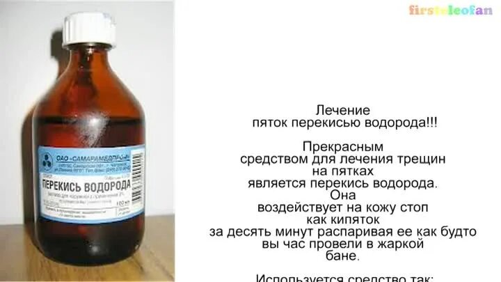 Аммиак и глицерин для пяток. Перекись глицерин и уксус для пяток. народные средства для пяток. перекись водорода для трещин на пятках.