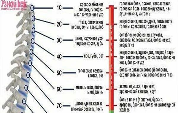 Поясница хей. Остеохондроз шейного отдела. Таблица болезней остеохондроз. Таблица шейных позвонков.