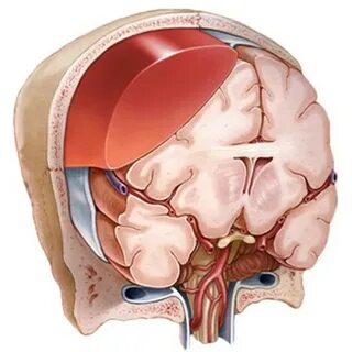 Гематома в мозгу после удара